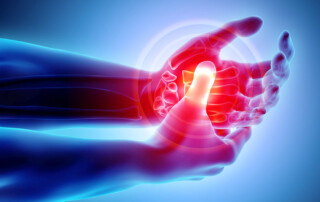 arthritic hands in pain